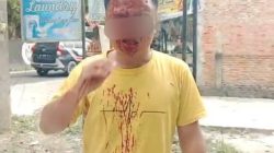 Ketua PMII Pekanbaru Desak Kapolda Riau dan Kapolresta Pekanbaru Segera Tangkap Pelaku Dugaan Pengeroyokan Sekretaris PKC PMII Riau